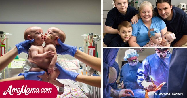 After a heavy two years in hospital, doctors finally share desirable news for conjoined twins