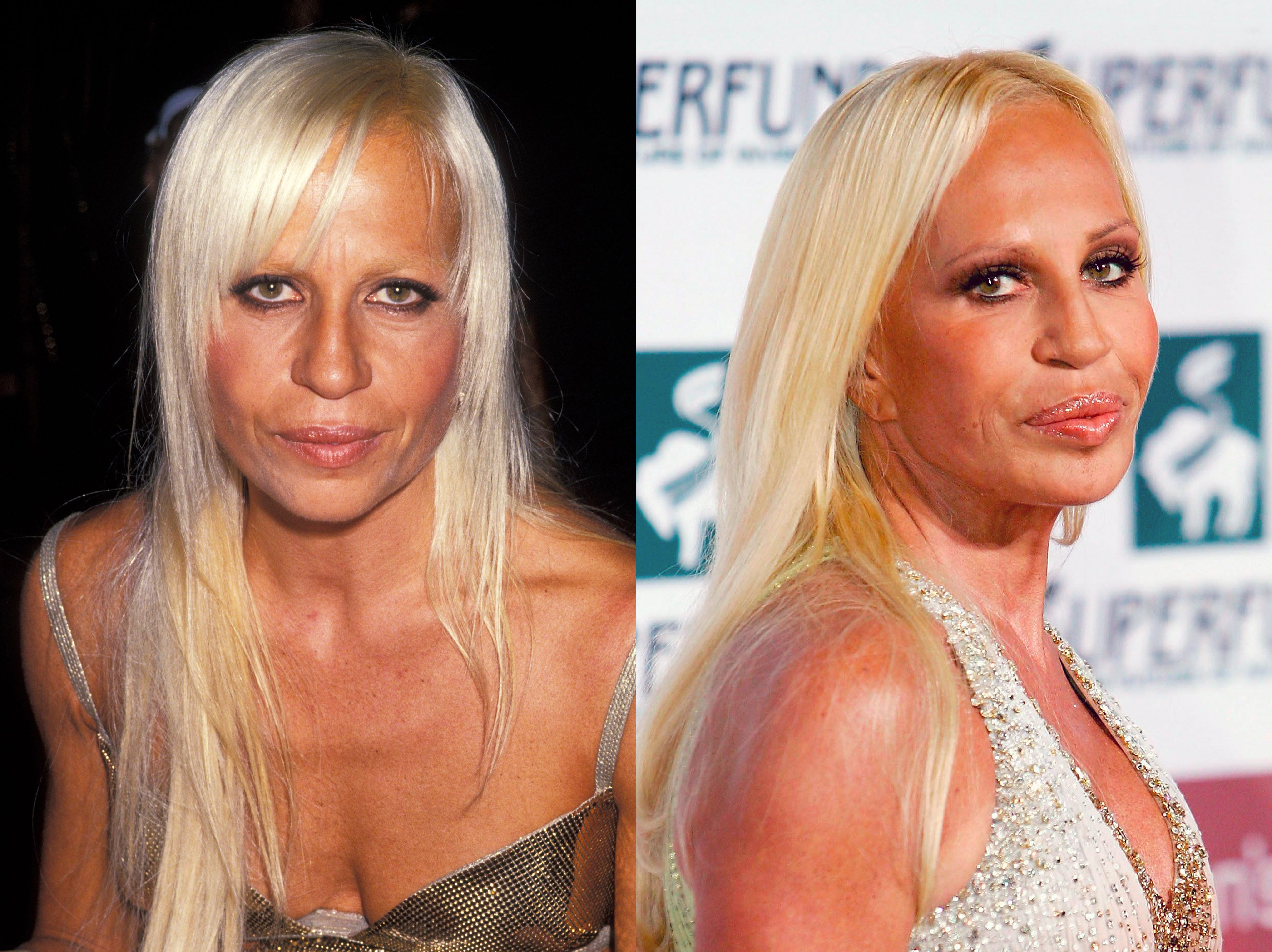 Donatella Versace in 1996 vs 2005 | Source: Getty Images