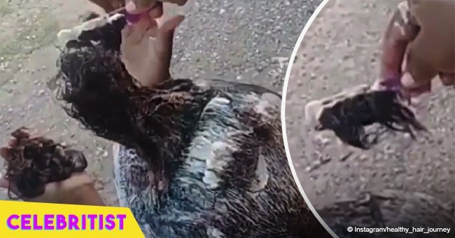 Terrifying video of woman's hair falling out goes viral