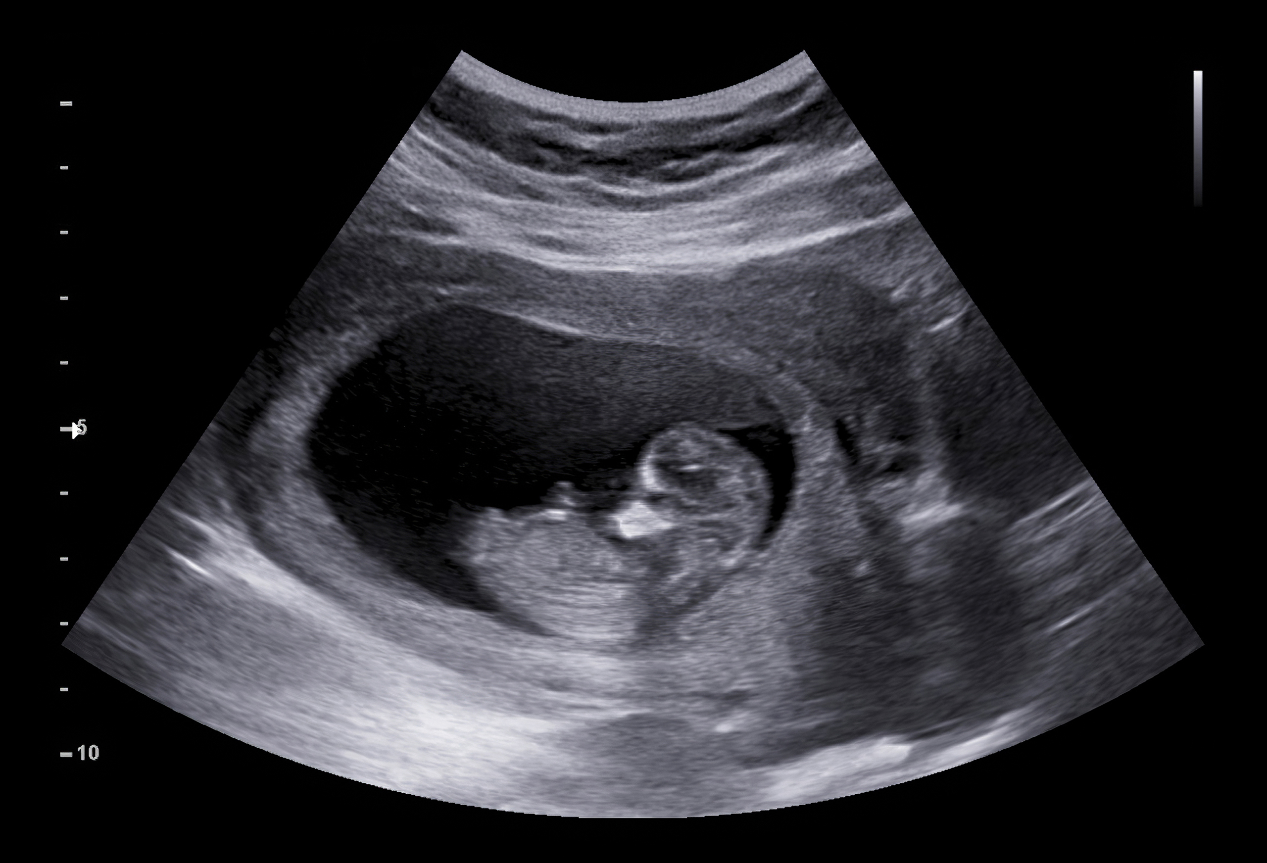 An ultrasound | Shutterstock