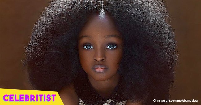 5-year-old girl is dubbed 'the most beautiful girl in the world' after her photos go viral