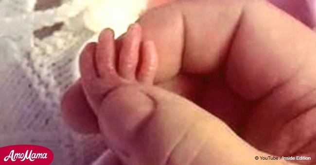 Baby born with feet the size of pennies looks healthy and happy now