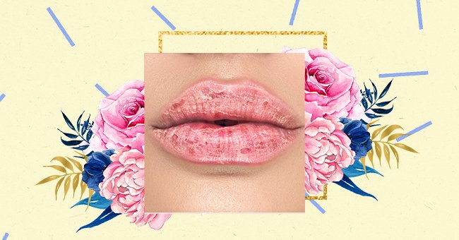 Lip Balm: Ultimate Dry Lip Treatment Or Waste Of Time?