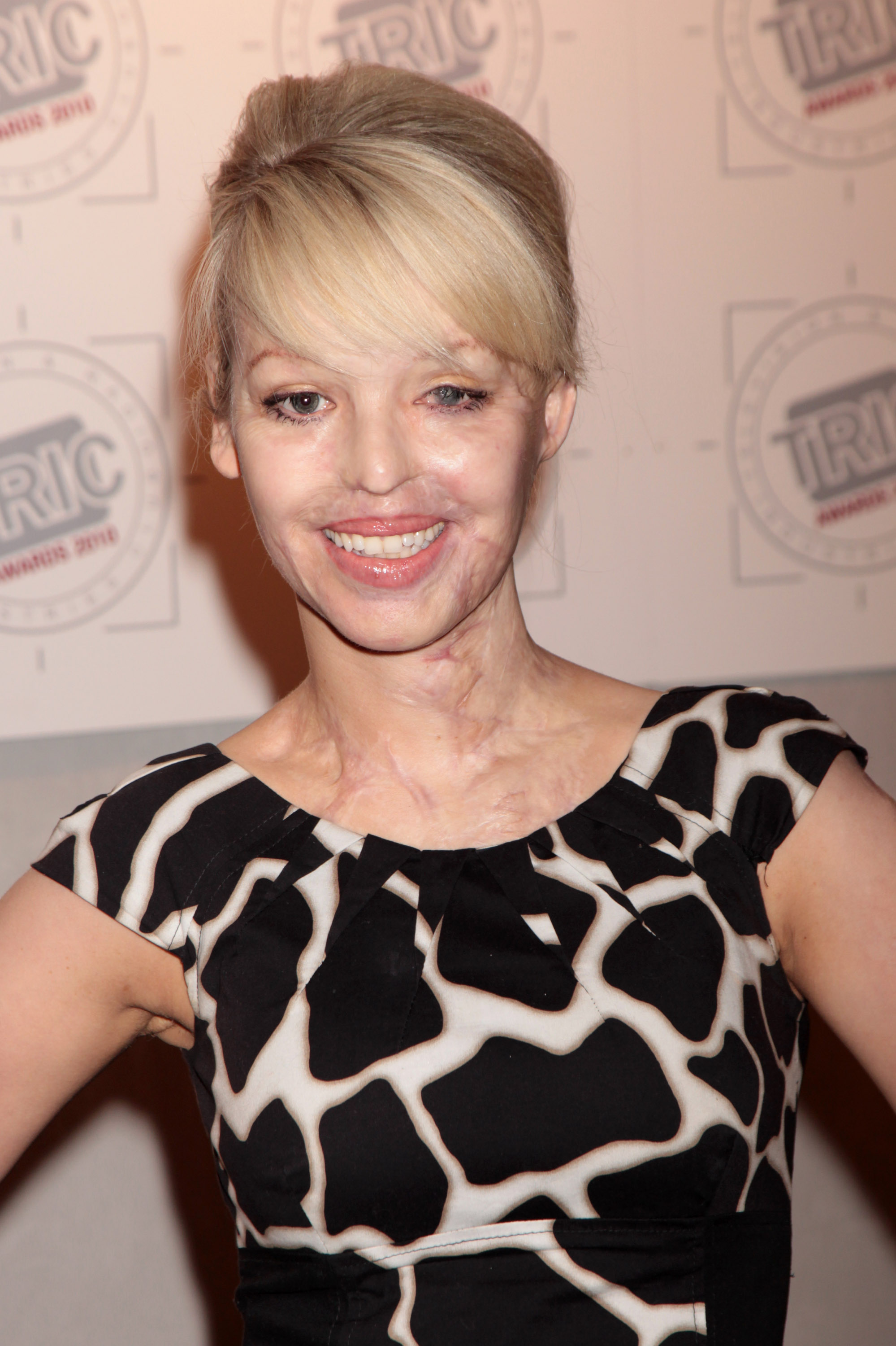 Katie Piper on March 9, 2010 in London, England | Source: Getty Images