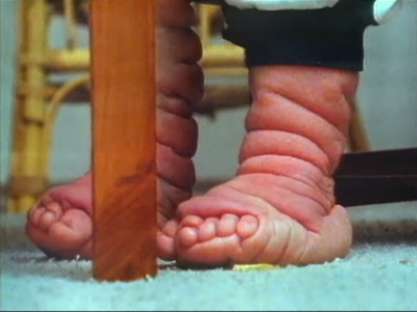 A close up of Tomm Tennent's wrinkled legs and feet | Source: YouTube.com/60 Minutes Australia