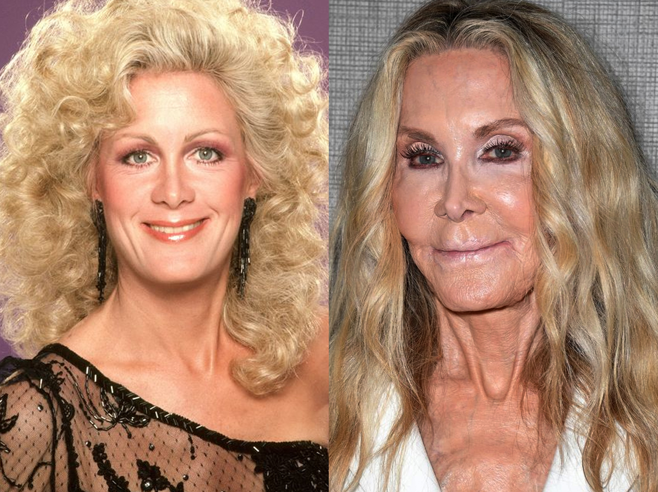 Joan Van Ark | Source: Getty Images