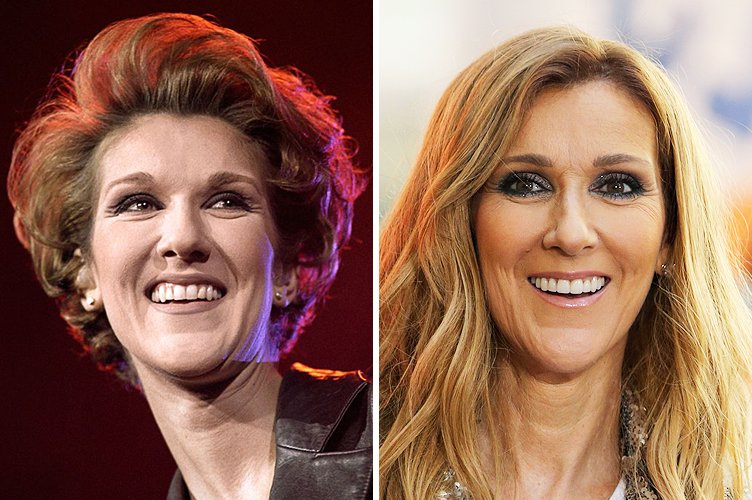 Céline Dion avant et après. ǀ Source : Getty Images