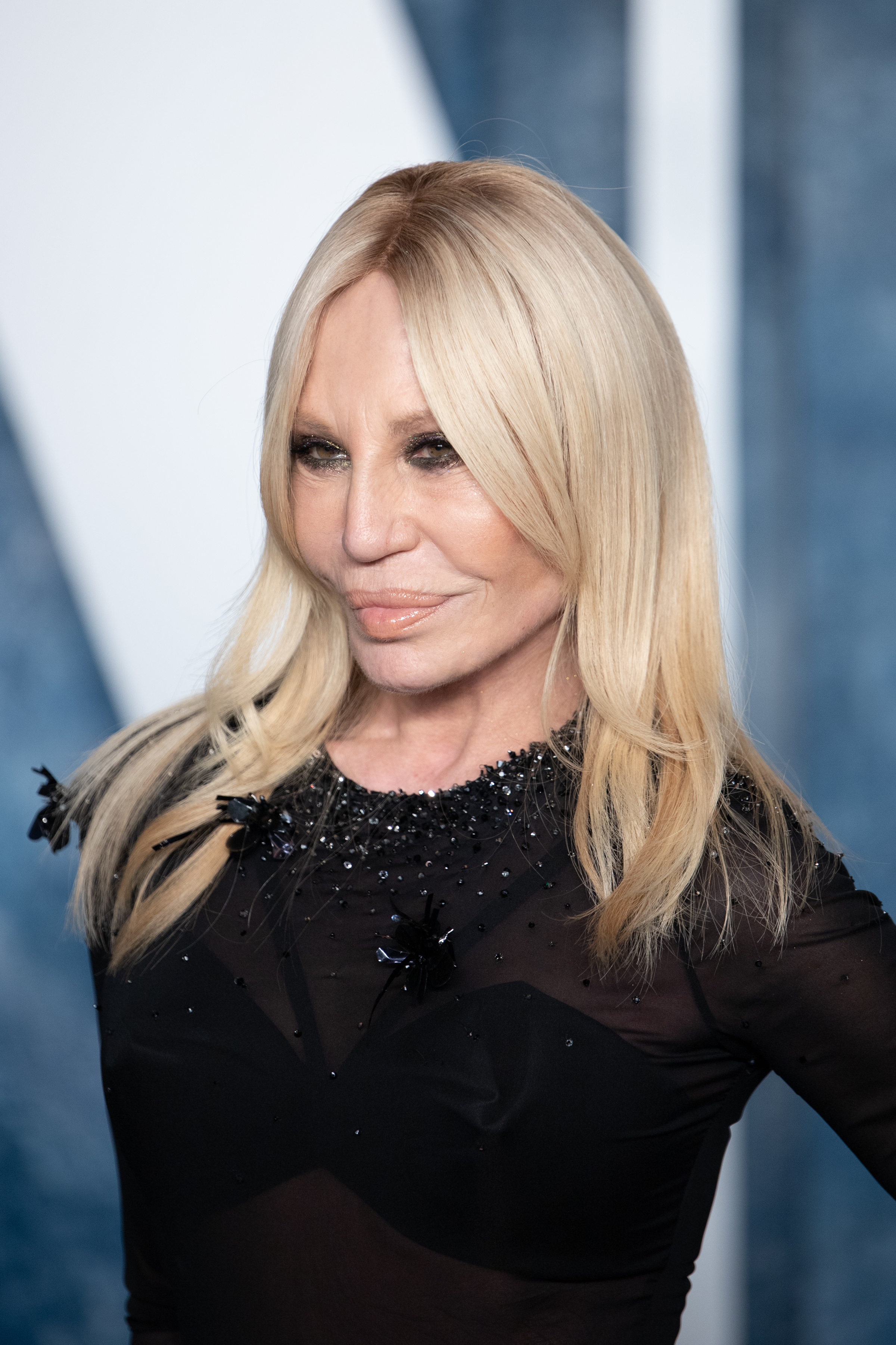Donatella Versace, 67, attended the Vanity Fair Oscar Party on March 12, 2023, in Beverly Hills, California. Her face showed deep creasing along the lower cheek and jawline, highly emphasized dark eyeshadow on her eyes, and a tense, upward curve to her voluminous, glossy lips.