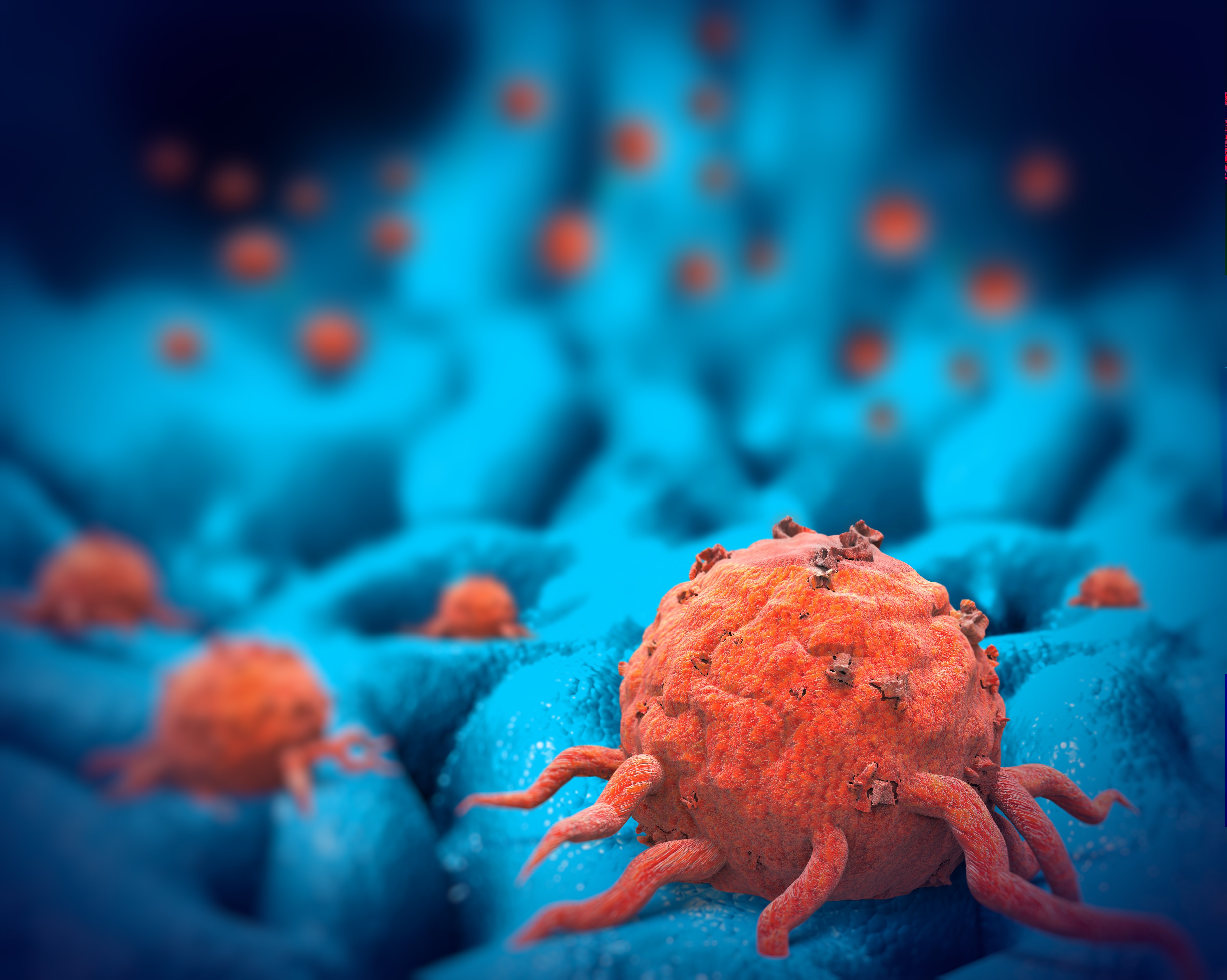 Cellules cancéreuses, illustration 3d. Photo : Shutterstock Cellules cancéreuses, illustration 3d. Photo : Shutterstock