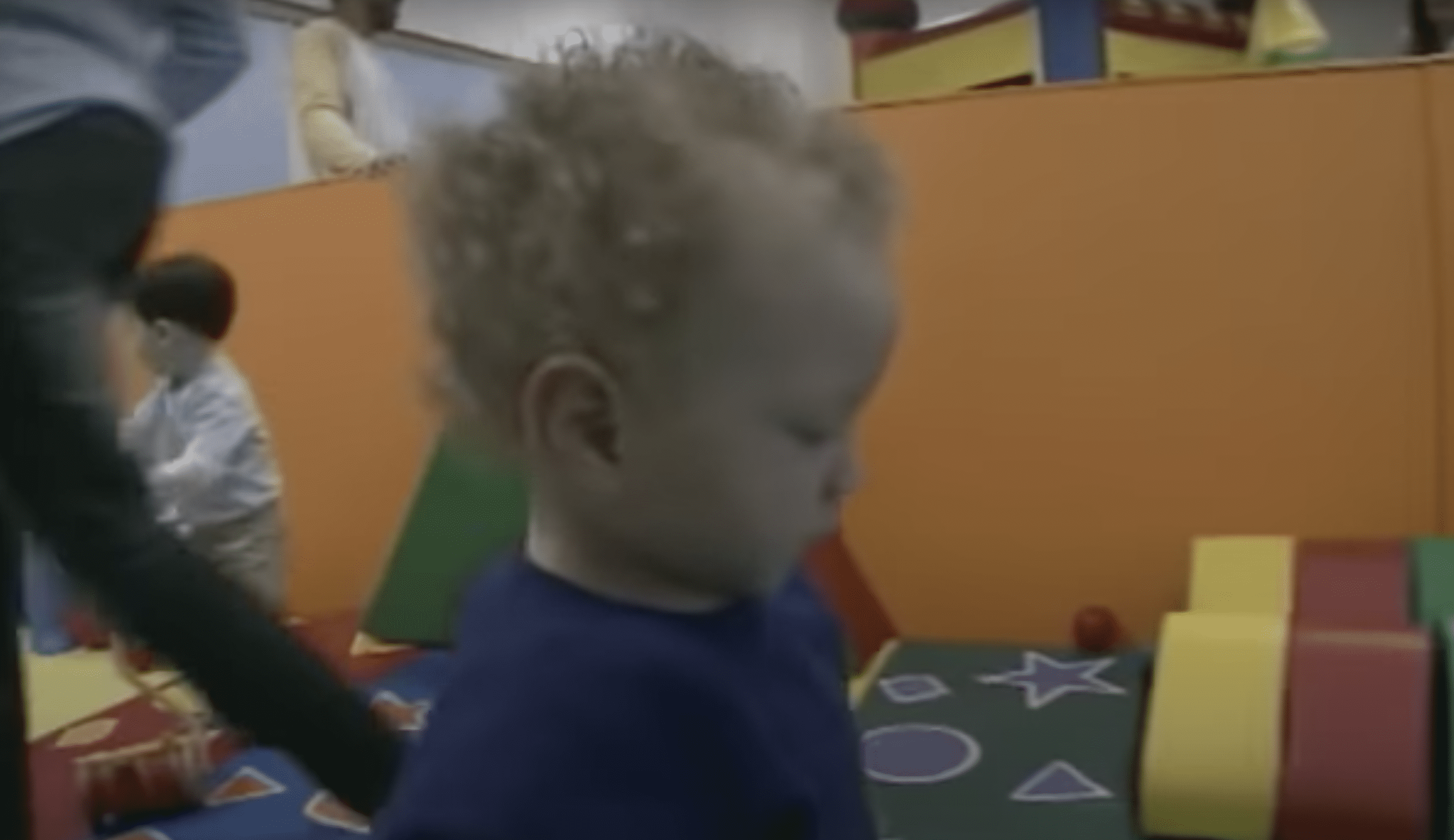 Doctor Baffled By This Woman's Microscopic Forehead.