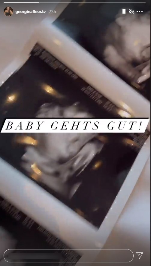 Foto des 3D-Ultraschalls des Babys, das von Georgina Fleur geteilt wurde | Quelle: Instagram/georginafleur.tv