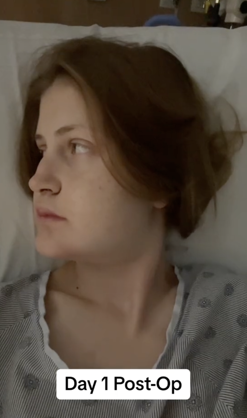 A side glance on Day 1 post-op reveals the extent of swelling and fatigue in Virginia Elder’s recovery. | Source: TikTok/virginiaeelder