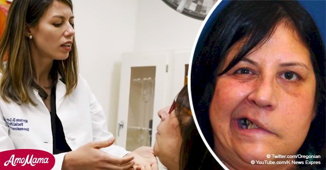 Woman felt like a ‘monster’ after her stroke, but marvelous makeover gives her a new smile