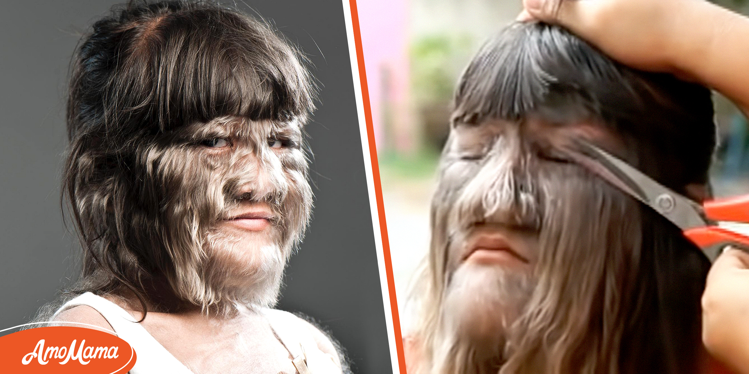 ‘Wolf Child’ Teased in School Turned Into Beautiful Woman