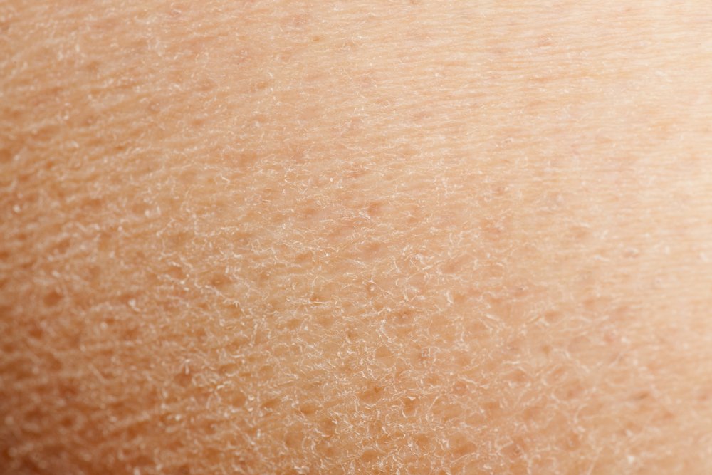 Un fondo macro-detallado de piel seca. | Foto: Shutterstock Un fondo macro-detallado de piel seca. | Foto: Shutterstock