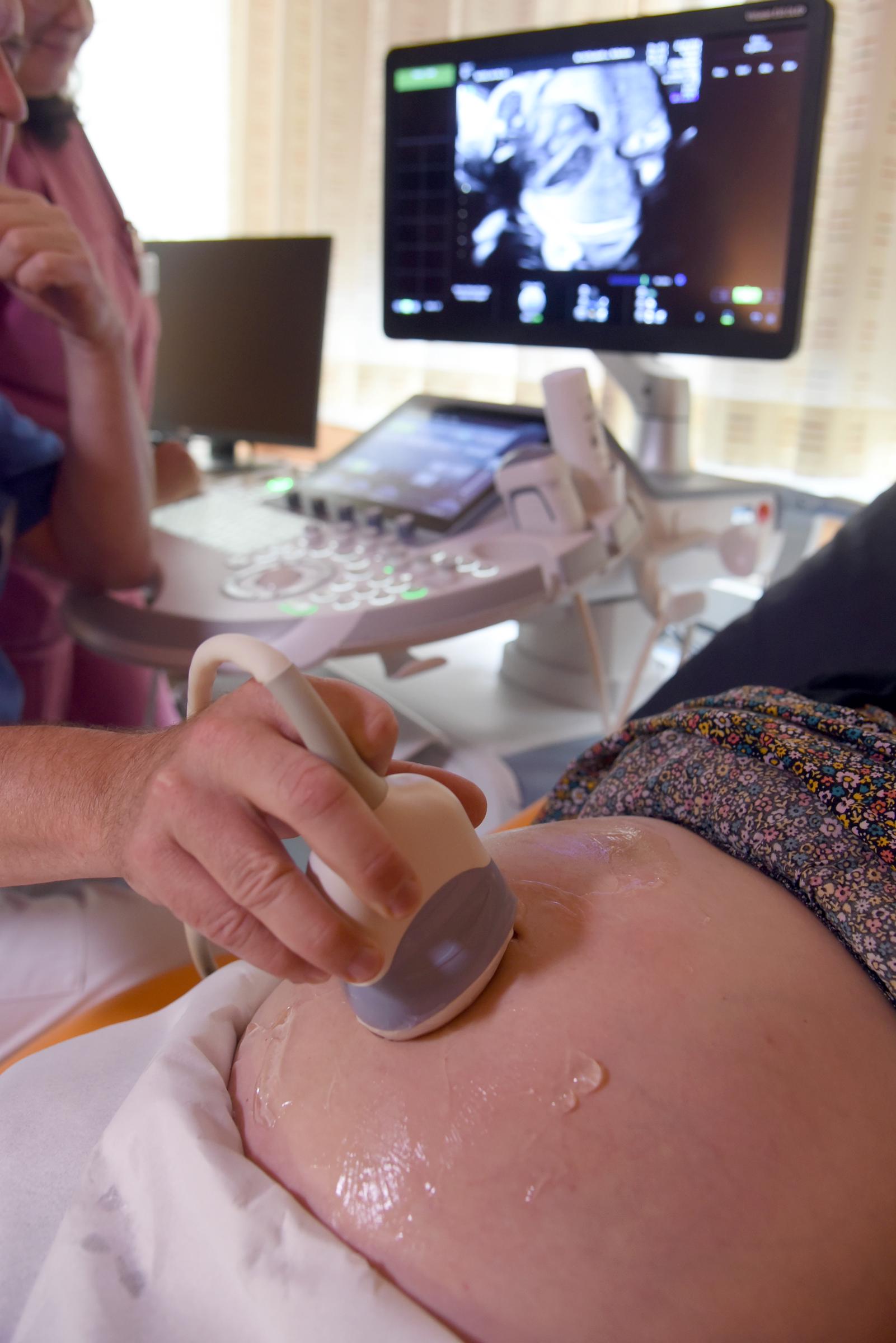 A head physician moves the ultrasound probe over a pregnant woman's abdomen during a fine diagnosis on August 22, 2024, at St. Elisabeth and St. Barbara Hospital | Source: Getty Images
