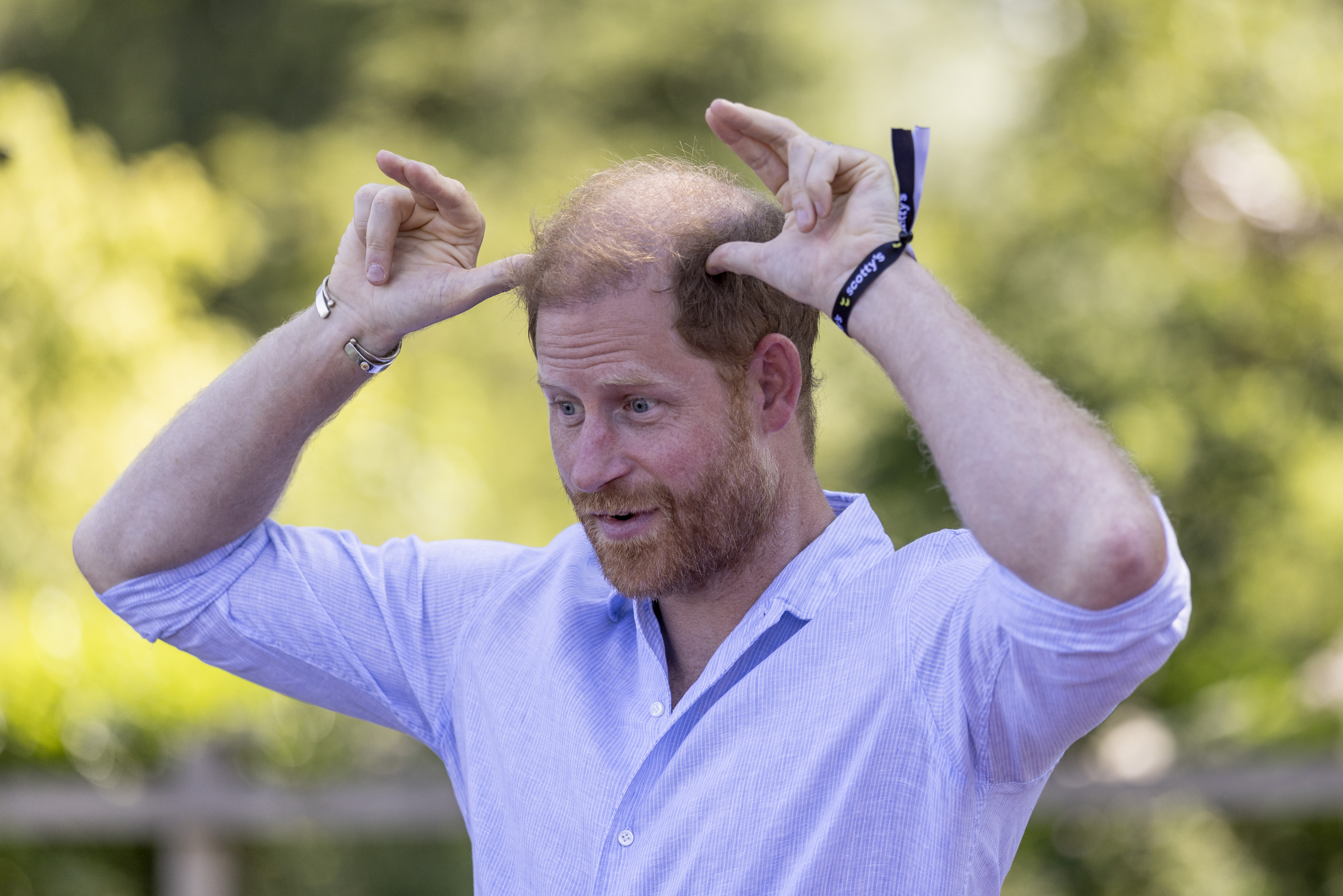 Harry has shown he is willing to make the subject part of the joke himself, even quipping during a recent Invictus Games appearance that "some of us have lost our hair." That makes the renewed social-media debate around his latest appearance especially timely. | Source: Getty Images