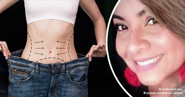 39-year-old woman dies after subjecting herself to a combination of plastic surgeries