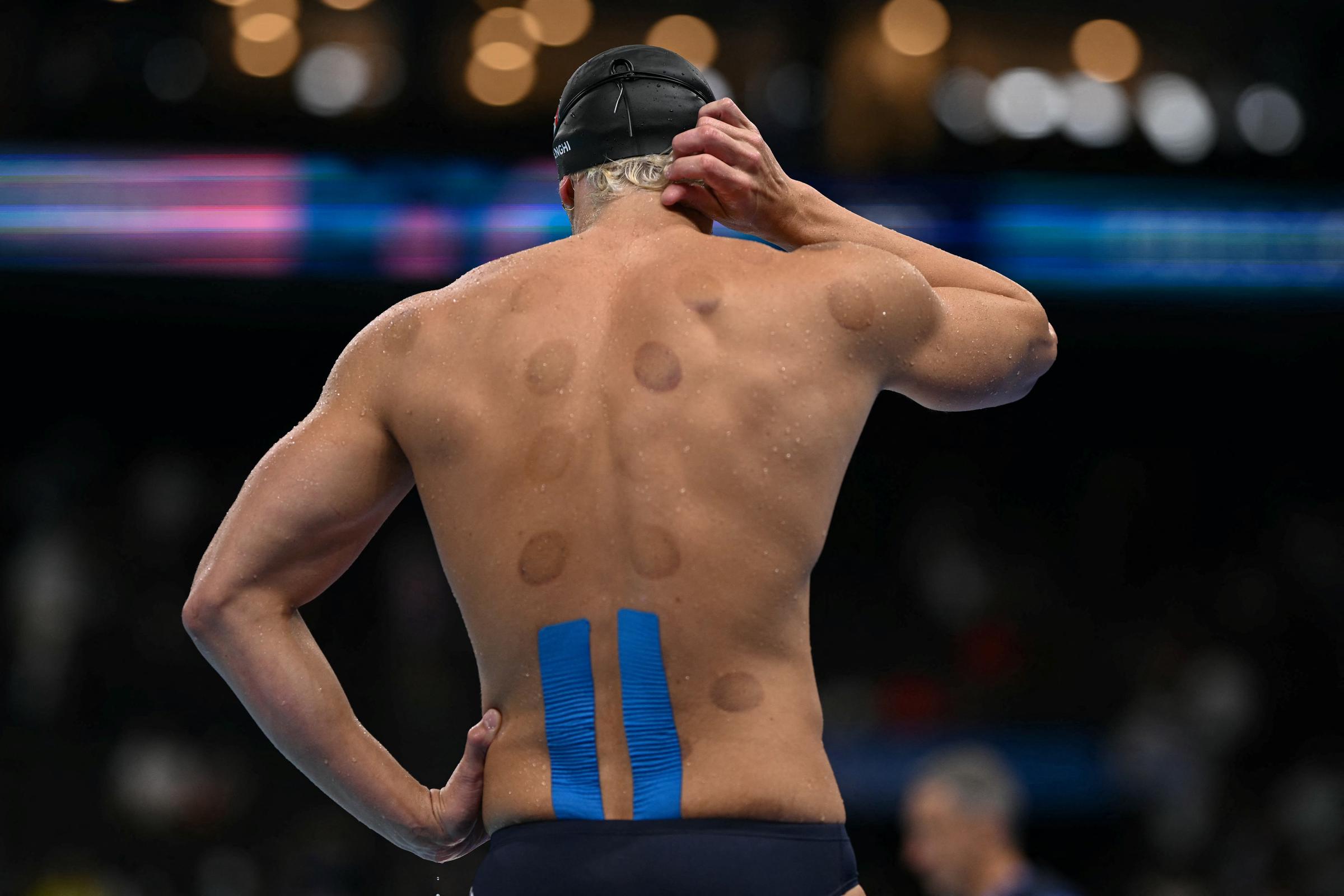 Nicolo Martinenghi of Italy displays dark circles on his back during the Paris 2024 Olympic Games at the Paris La Defense Arena in Nanterre on August 1, 2024 | Source: Getty Images