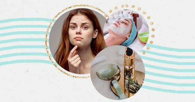 10 Ways To Reduce The Appearance of Acne Scars