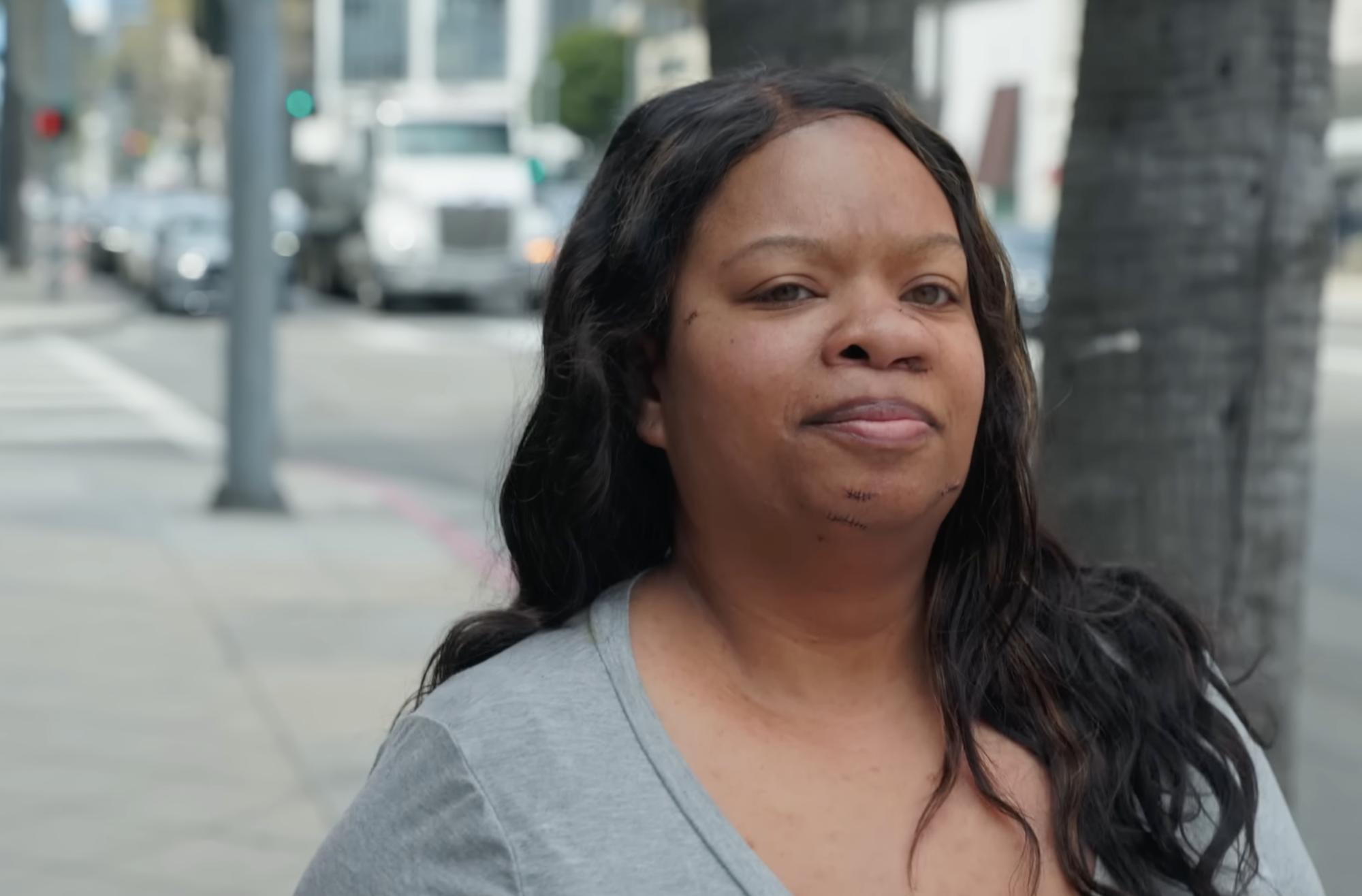 Danielle seen after surgery | Source: You Tube/@Dr.Truesdale