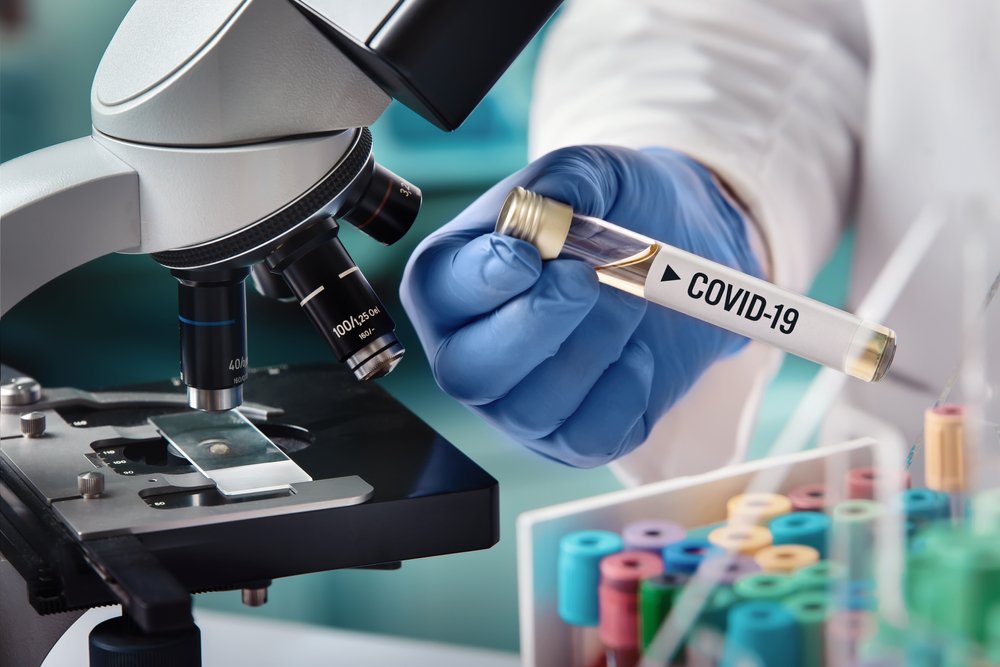 Microbiólogo sosteniendo un tubo de ensayo con la etiqueta COVID-19. I Foto: Shutterstock