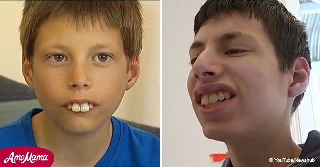 Boy bullied for buck teeth received orthodontic work through the kindness of strangers