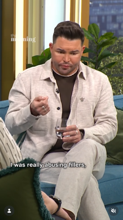 Leaning forward with a pointed gesture, Norris holds a glass of water as he addresses his years of filler use candidly — a moment that had the studio listening closely. | Source: Instagram/thismorning