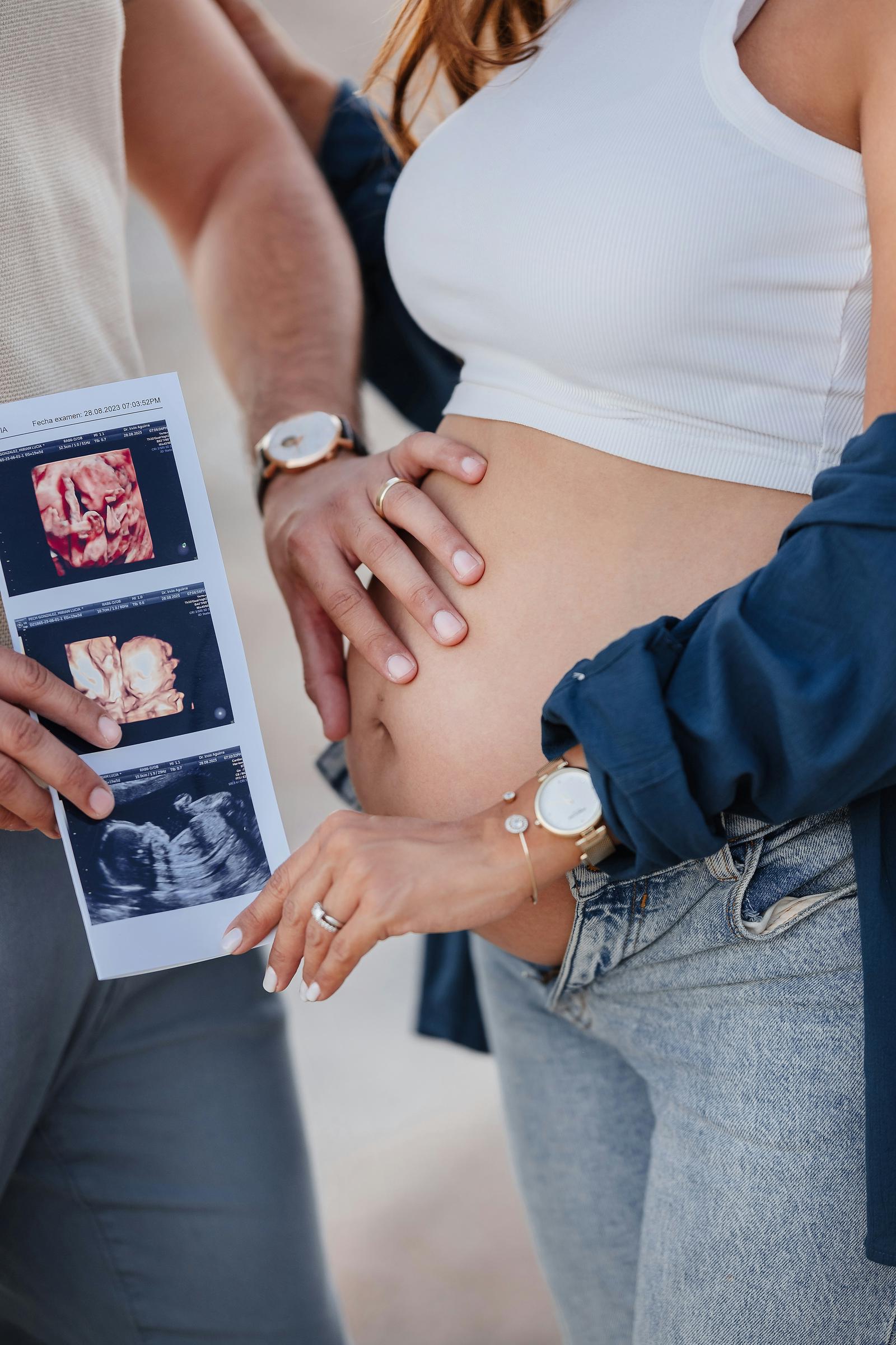 A pregnant woman and a man holding a sonogram | Source: Unsplash