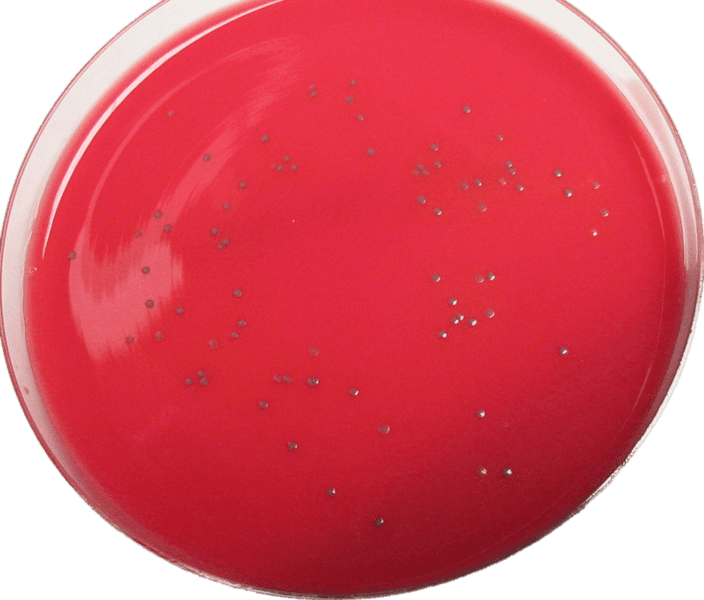 Listeria monocytogenes cultivada en agar Bio-Rad RAPID'L. Mono®. | Imagen: Wikipedia
