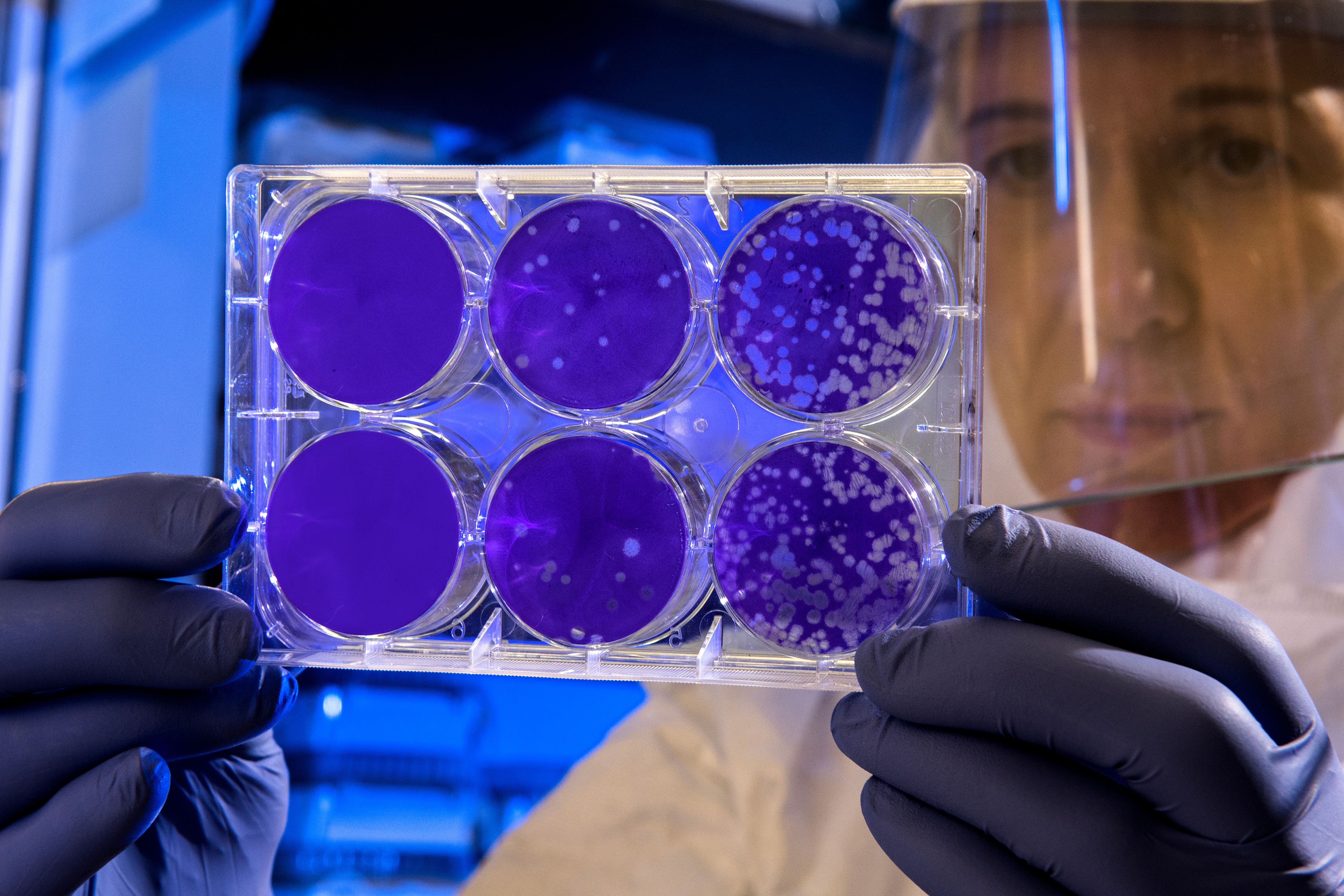 A CDC scientist examining results from a test in 2019. | Source: Getty Images