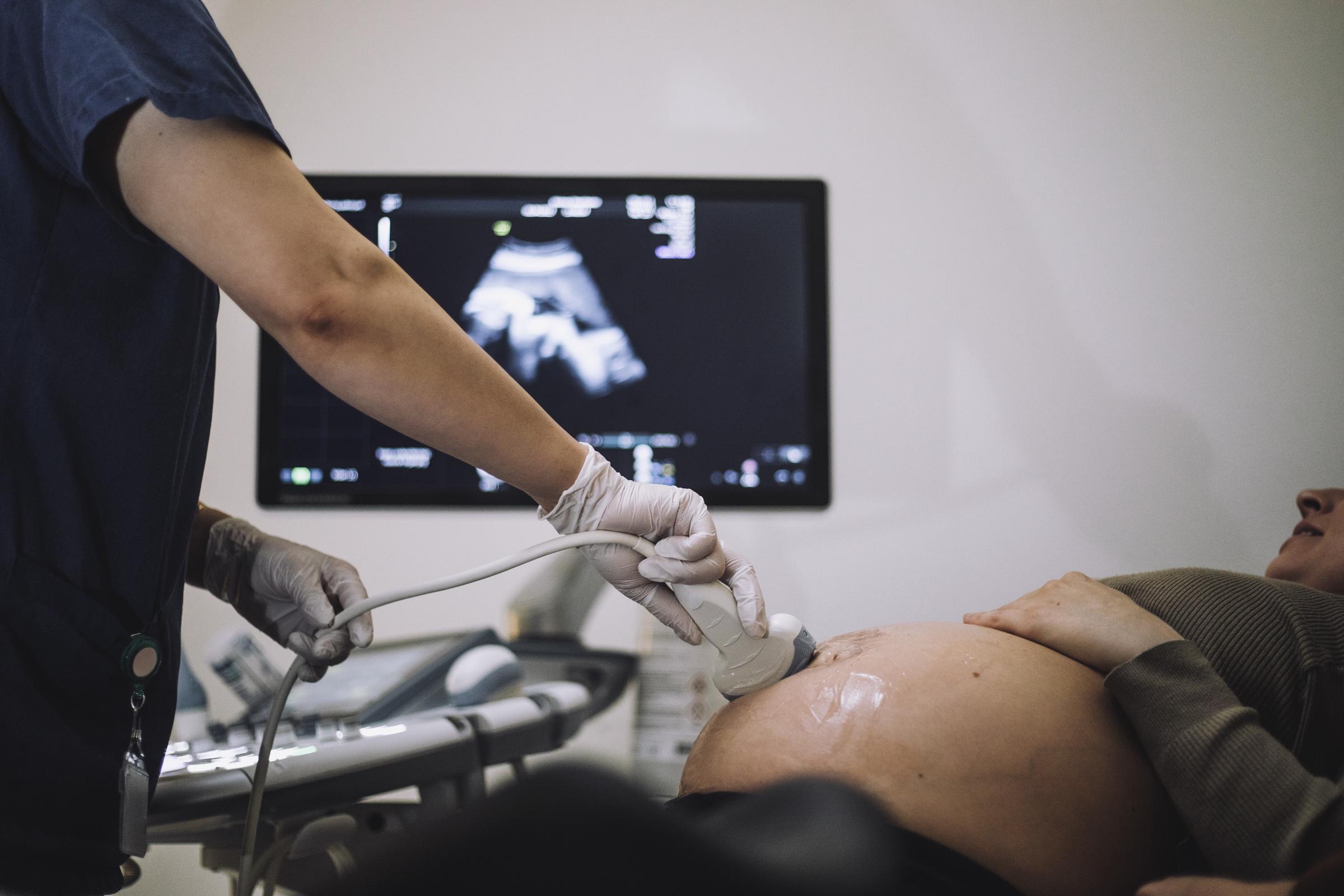 A pregnant woman getting an ultrasound in a hospital | Source: Getty Images