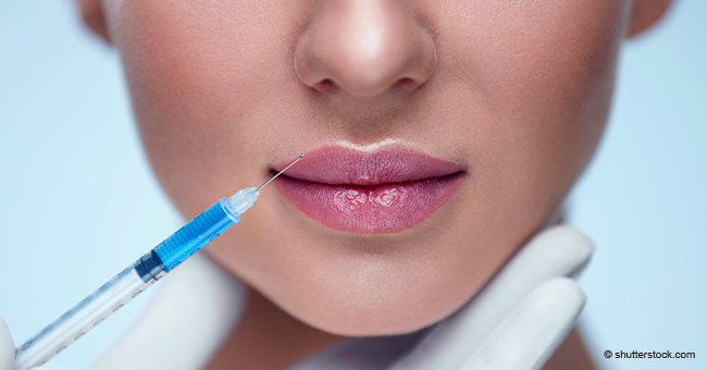 $100 Botched Procedure Leaves Woman with Enormous 'Sausage Lips'