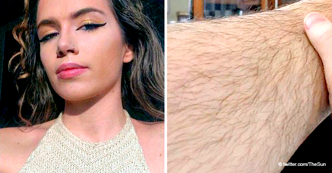 Student Who Stopped Shaving Legs 4 Months Ago Reveals She Was Bombarded by Cruel Comments