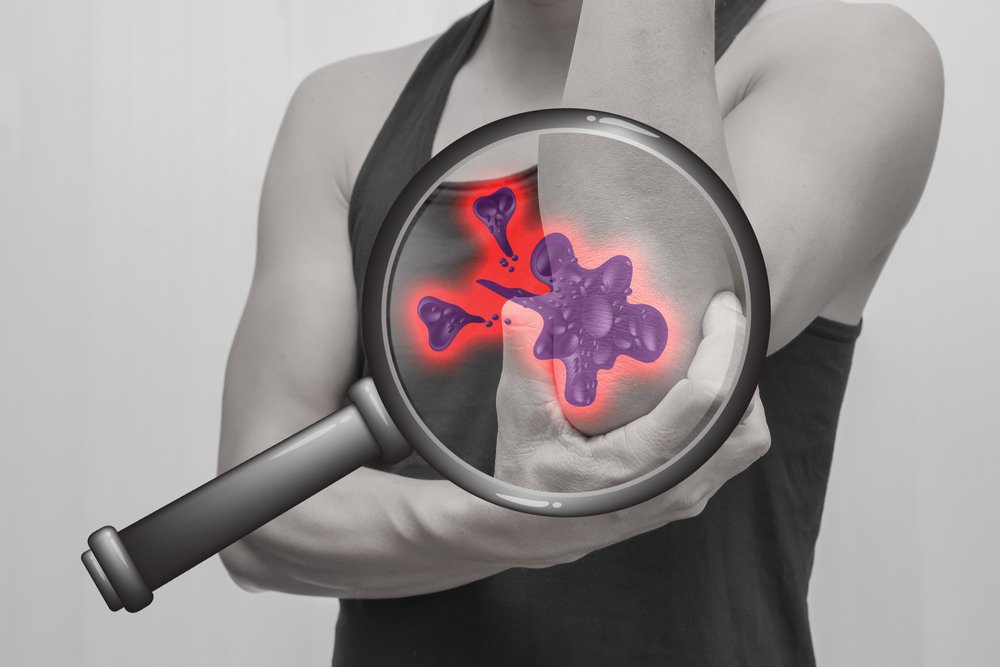 Femme aux douleurs aux articulations. | Photo : Shutterstock Femme aux douleurs aux articulations. | Photo : Shutterstock
