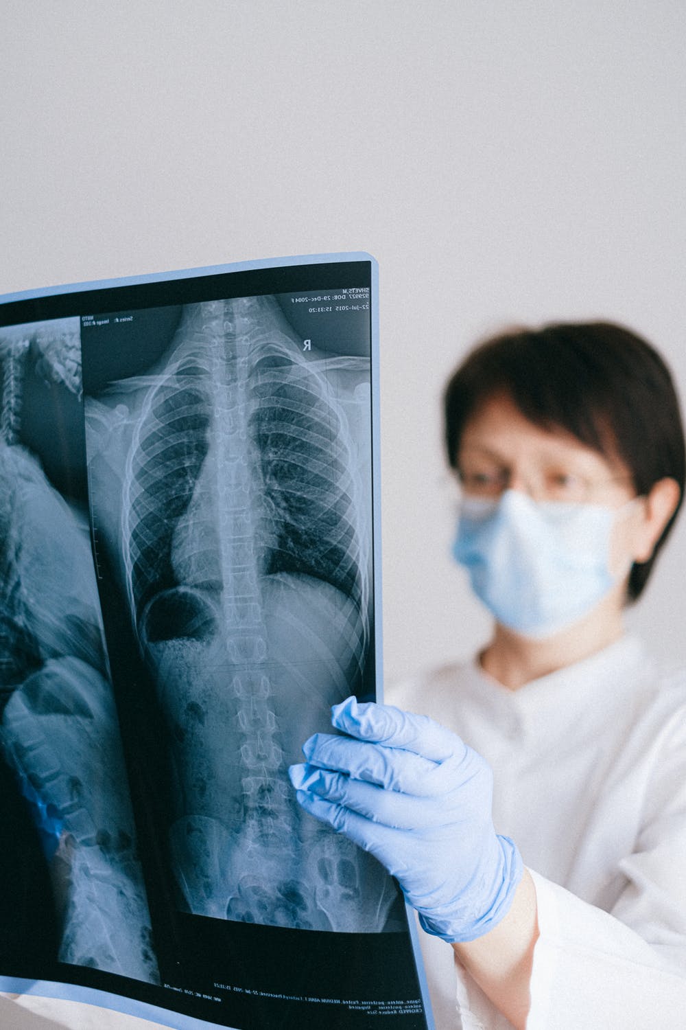 The doctor took X-rays of Mrs. Ross' arm | Source: Pexels