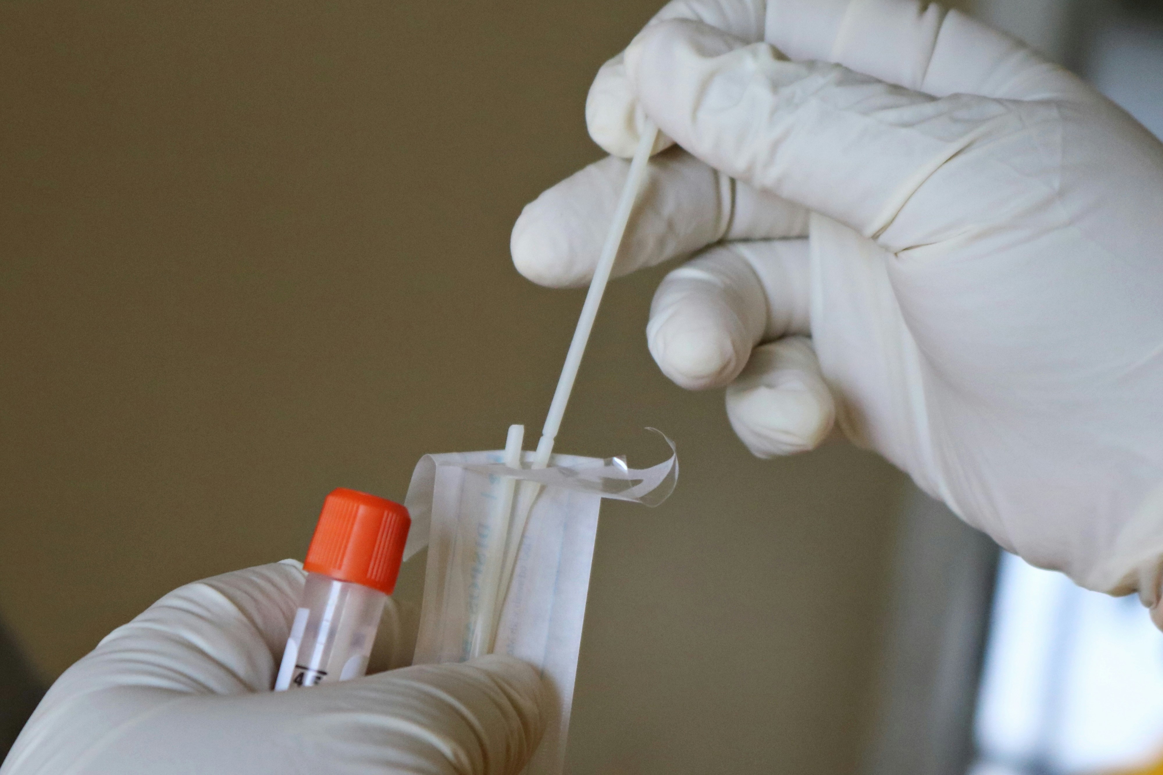 A person doing a DNA test | Source: Unsplash