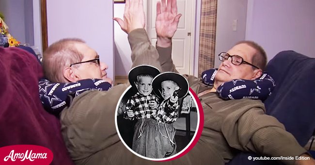 Oldest Set Of Conjoined Twins Ronnie And Donnie Gaylon Pass Away At Age 68