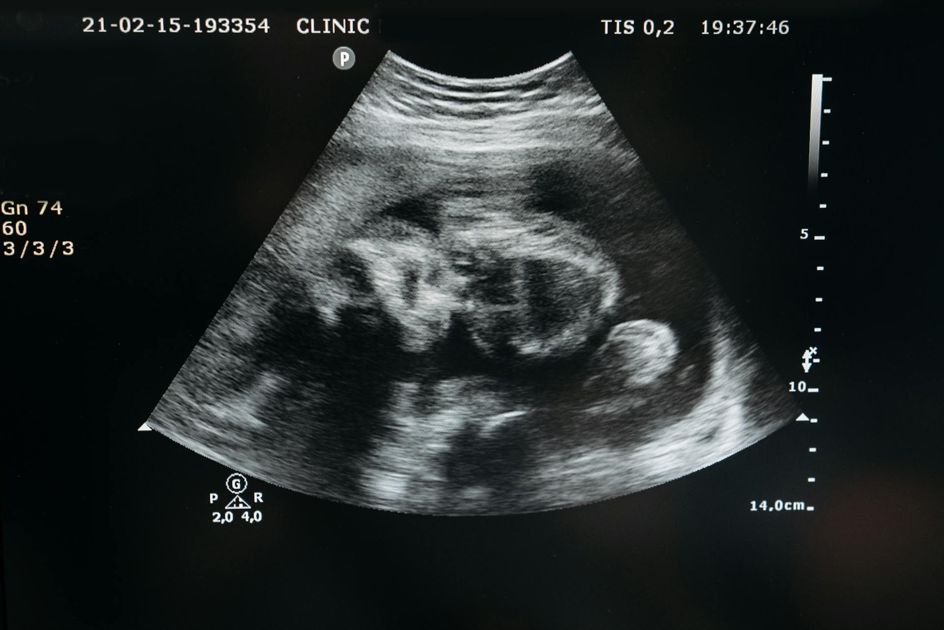 An ultrasound of an unborn baby | Source: Pexels