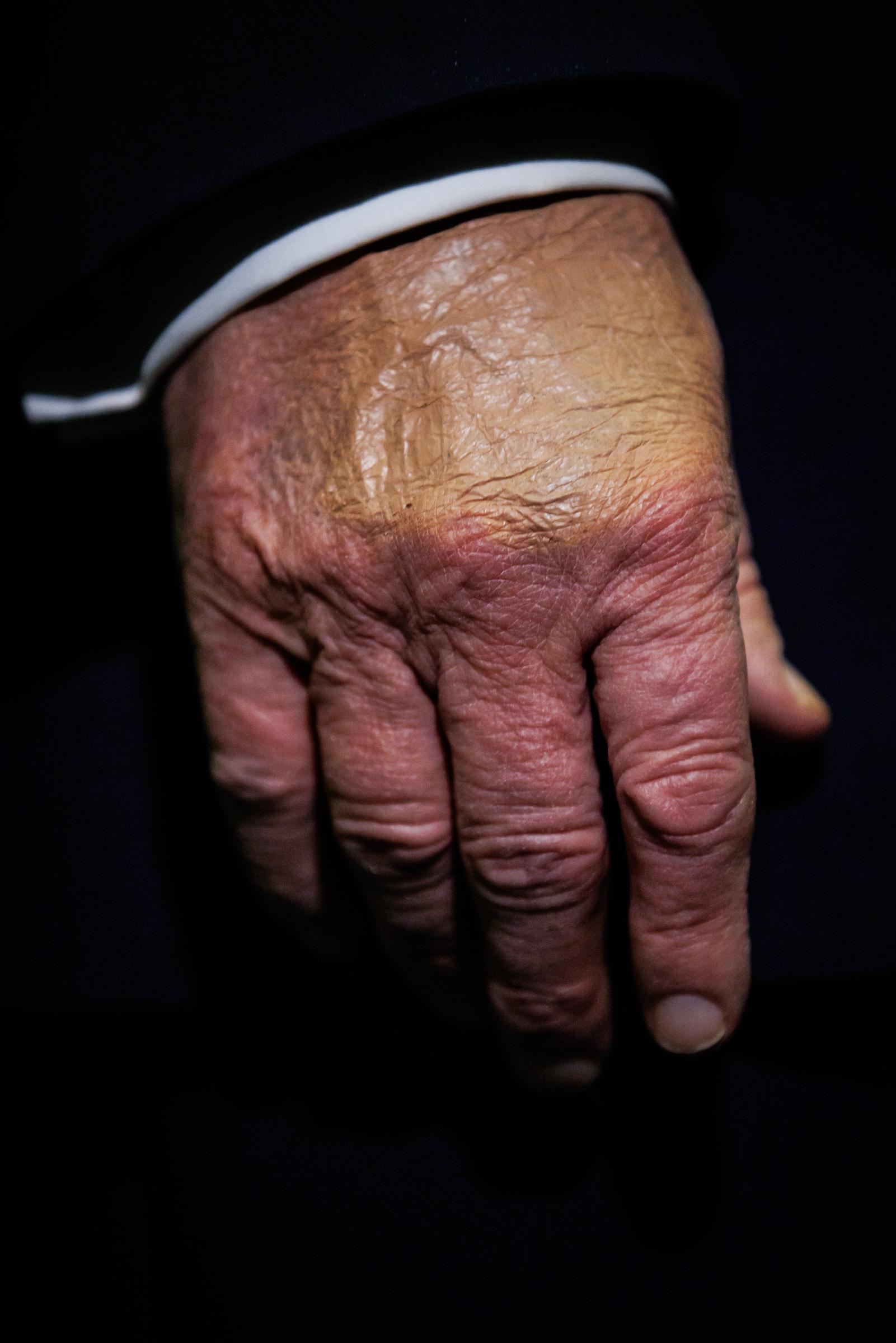 Donald Trump's hand is seen during a gaggle with reporters while aboard Air Force One on February 6, 2026 en route to Palm Beach, Florida | Source: Getty Images