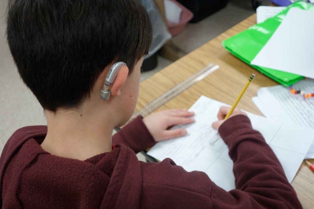 Un garçon avec un appareil auditif. | Photo : Getty Images